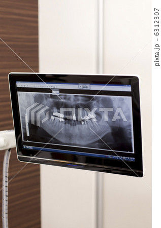 デンタルエックス線写真 デンタル（口内法）】KDEX-SⅡ｜株式会社近畿レントゲン工業社