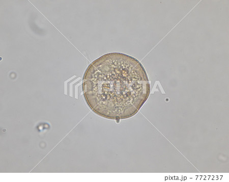 微生物 ナベカムリ アメーバ 有殻の写真素材