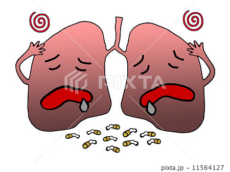 肺 肺がん タール 不健康のイラスト素材