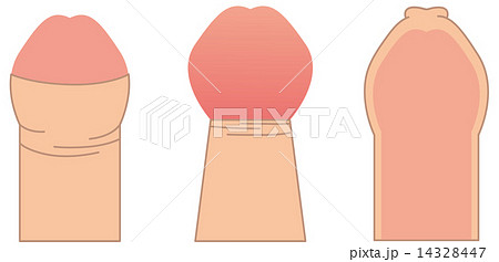 仮性包茎 男性器 イラスト ペニスのイラスト素材