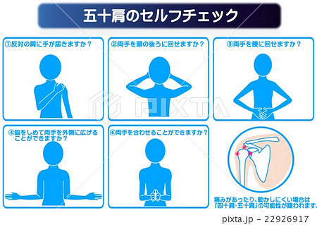 肩関節周囲炎のイラスト素材