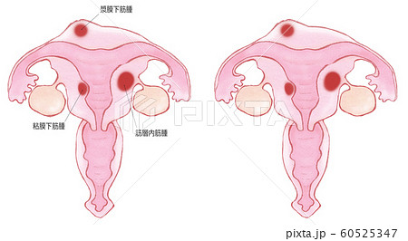 子宮 断面図 女性 体の写真素材