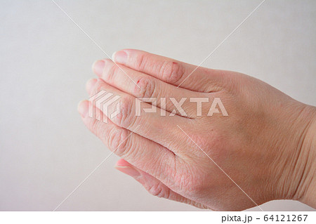 肌割れの写真素材