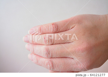 肌割れの写真素材