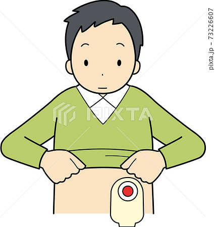 ストーマのイラスト素材