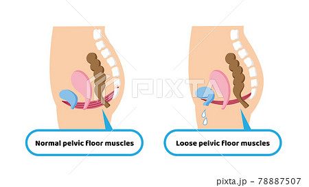 骨盤底筋のイラスト素材