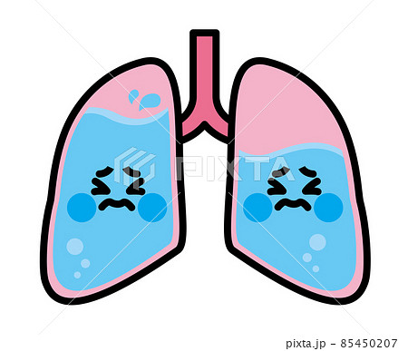 肺水腫のイラスト素材