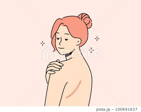 Woman breast cutaway diagram. - Stock Illustration [29109330] - PIXTA