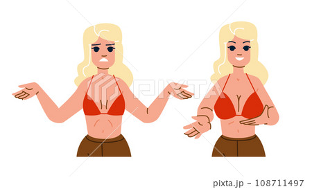 Female Breast Set. Different Types, Size and Form - Stock Illustration  [22923332] - PIXTA